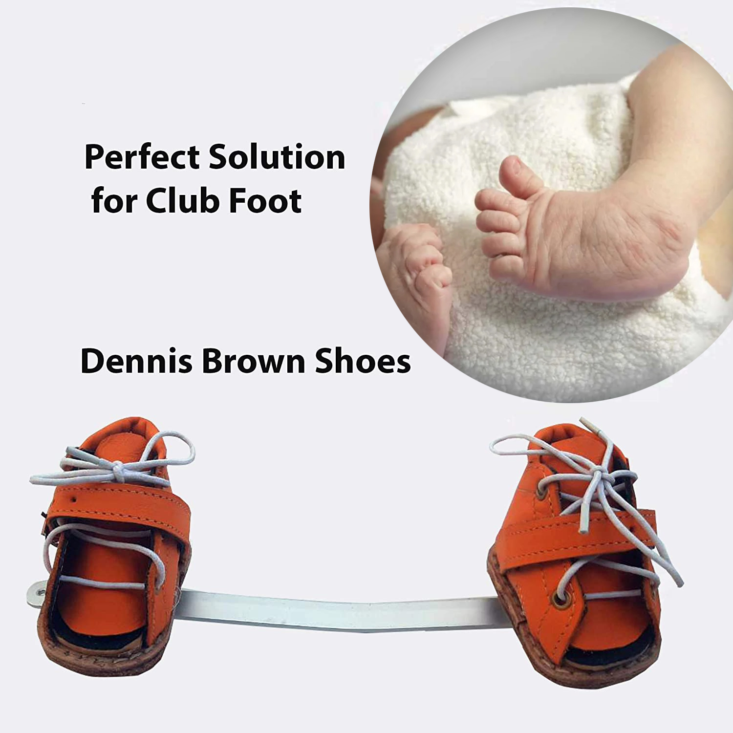 Denis Browne Splint kaushambi Ghaziabad